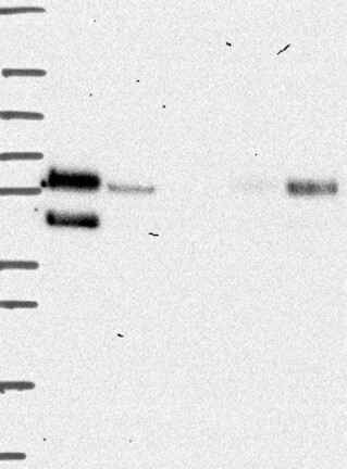 Atlas Antibodies Anti-PRCP Antibody