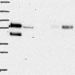 Atlas Antibodies Anti-PRCP Antibody