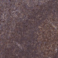 Atlas Antibodies Anti-PRDM1 Antibody