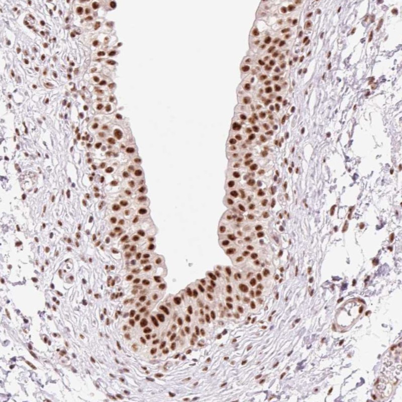 Atlas Antibodies Anti-PRDM11 Antibody