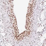 Atlas Antibodies Anti-PRDM11 Antibody