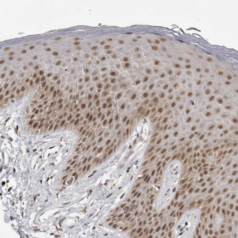 Atlas Antibodies Anti-PRDM10 Antibody