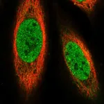 Atlas Antibodies Anti-PRDM14 Antibody