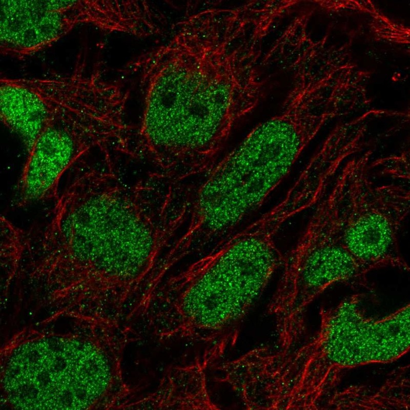 Atlas Antibodies Anti-PRDM16 Antibody
