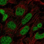 Atlas Antibodies Anti-PRDM16 Antibody
