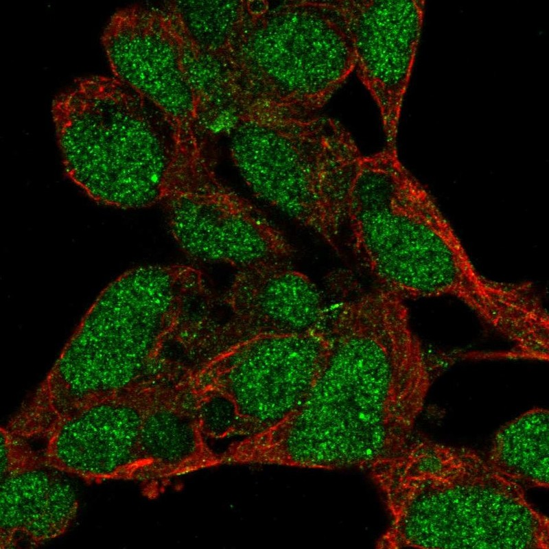 Atlas Antibodies Anti-PRDM16 Antibody