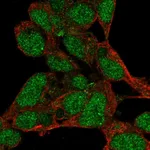 Atlas Antibodies Anti-PRDM16 Antibody