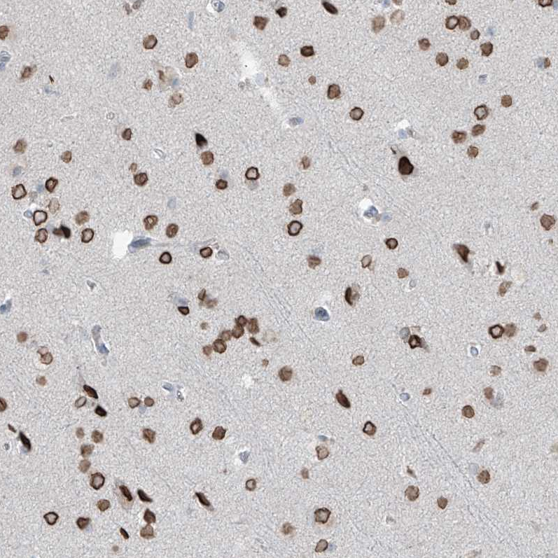 Atlas Antibodies Anti-PRDM6 Antibody