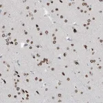Atlas Antibodies Anti-PRDM6 Antibody