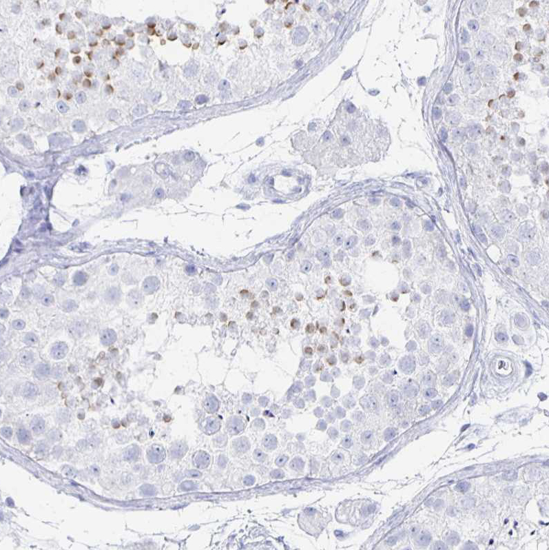 Atlas Antibodies Anti-PRDM7 Antibody