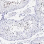 Atlas Antibodies Anti-PRDM7 Antibody