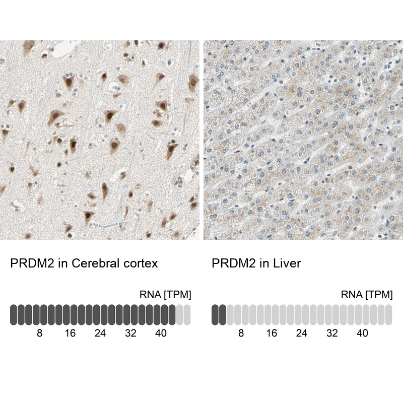 Atlas Antibodies Anti-PRDM2 Antibody