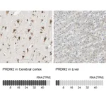 Atlas Antibodies Anti-PRDM2 Antibody
