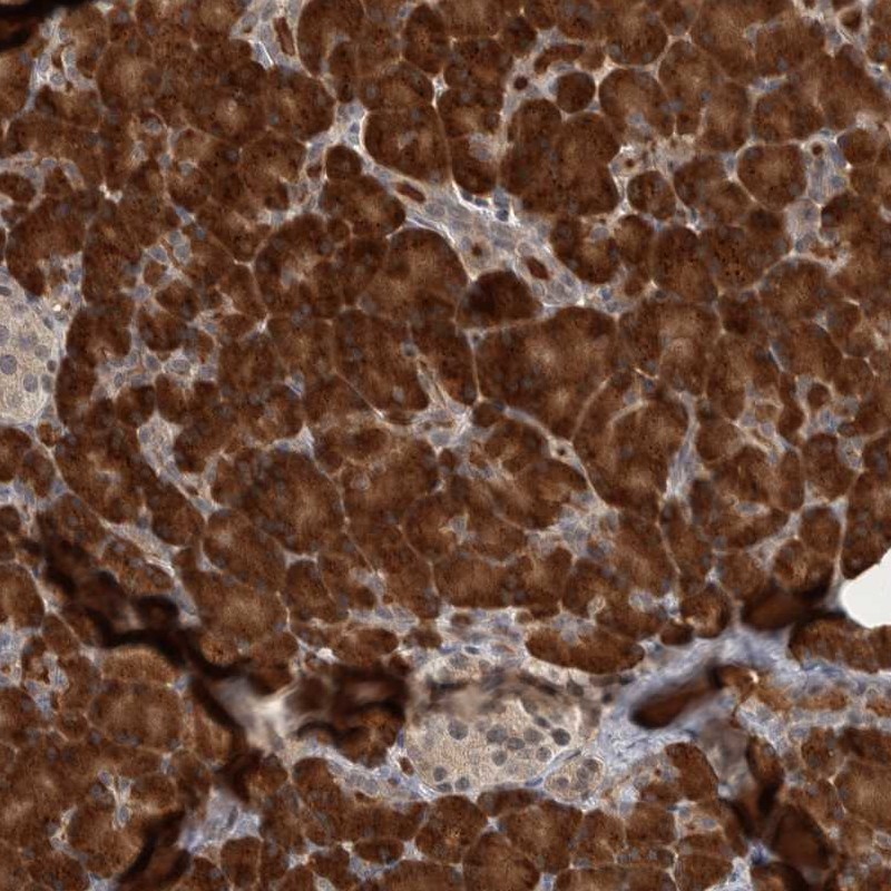 Atlas Antibodies Anti-PRDM4 Antibody