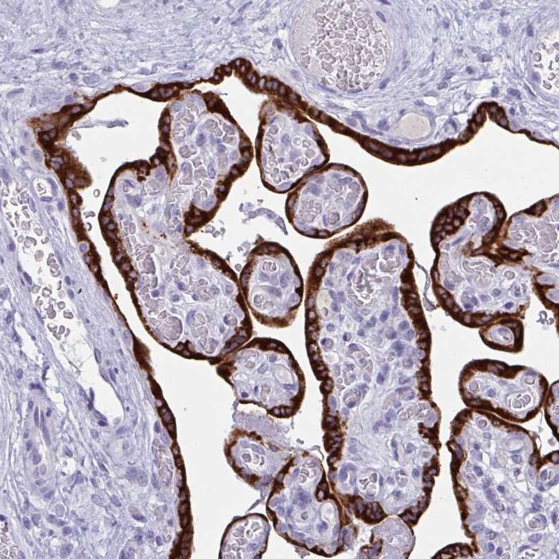 Atlas Antibodies Anti-PRDM9 Antibody