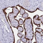 Atlas Antibodies Anti-PRDM9 Antibody