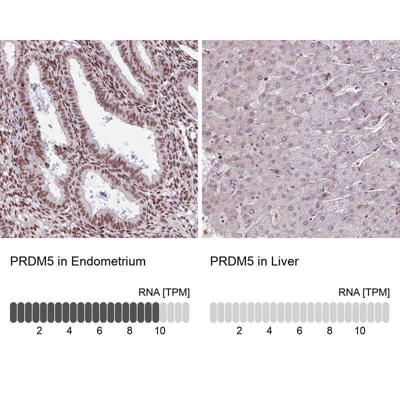Atlas Antibodies Anti-PRDM5 Antibody