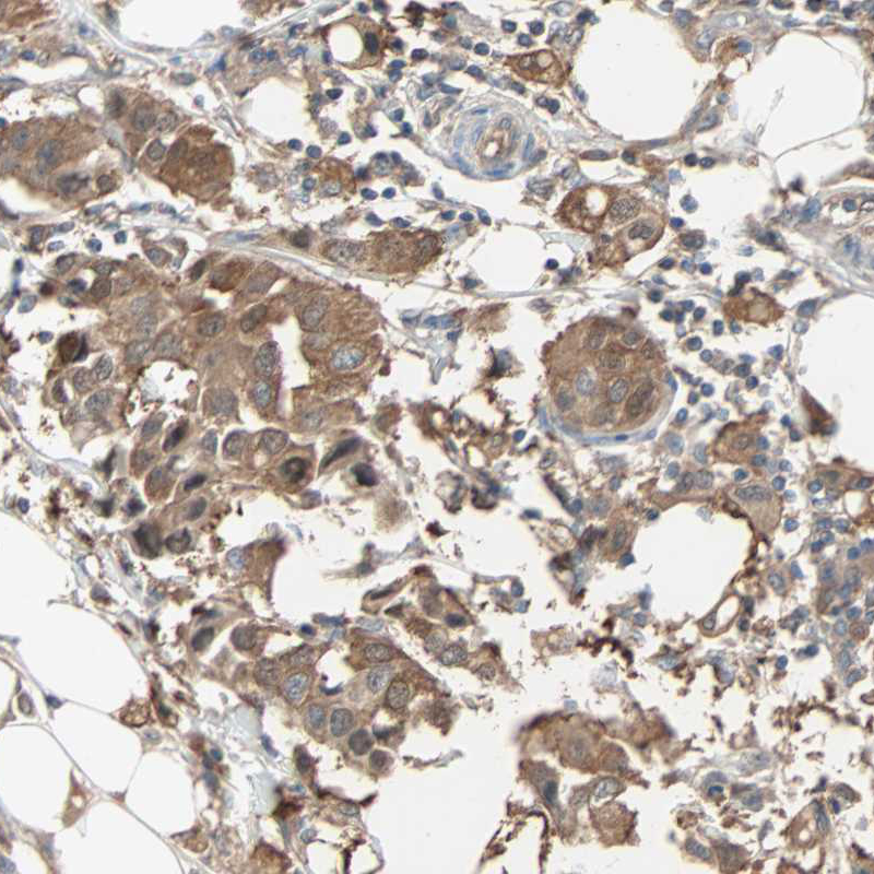 Atlas Antibodies Anti-PRDX1 Antibody