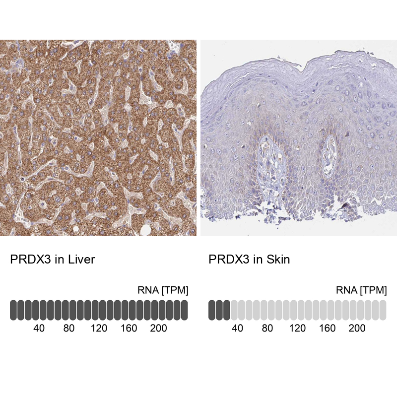 Atlas Antibodies Anti-PRDX3 Antibody