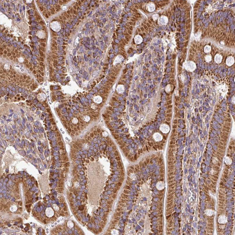 Atlas Antibodies Anti-PRELID3B Antibody