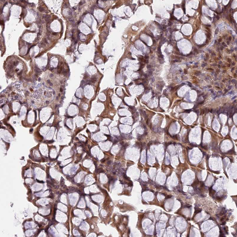 Atlas Antibodies Anti-PRELID2 Antibody