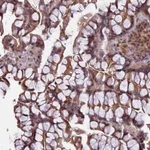 Atlas Antibodies Anti-PRELID2 Antibody