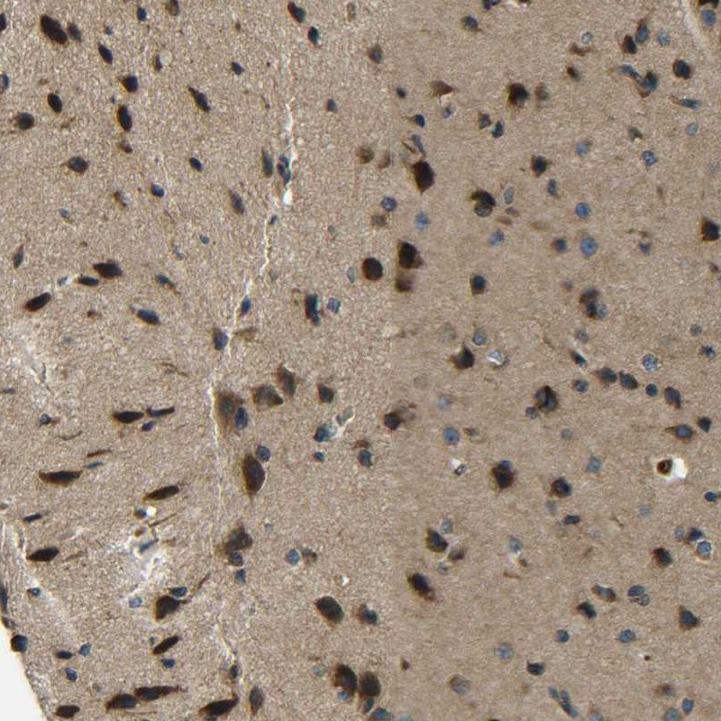 Atlas Antibodies Anti-PREB Antibody