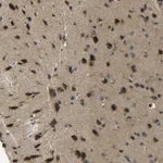 Atlas Antibodies Anti-PREB Antibody