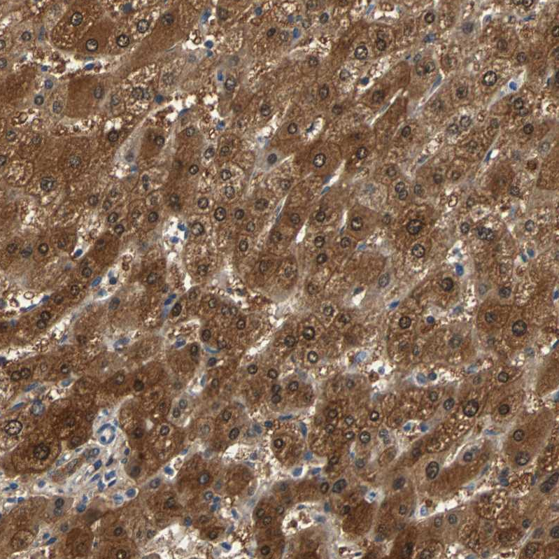 Atlas Antibodies Anti-PRDX6 Antibody