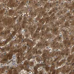 Atlas Antibodies Anti-PRDX6 Antibody