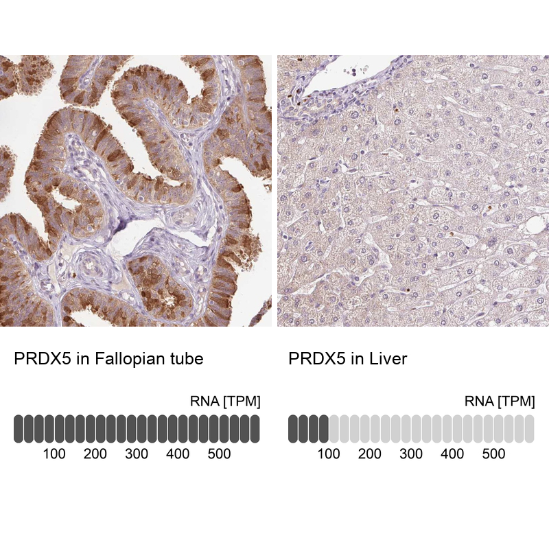 Atlas Antibodies Anti-PRDX5 Antibody