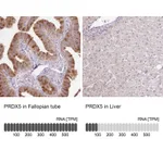 Atlas Antibodies Anti-PRDX5 Antibody