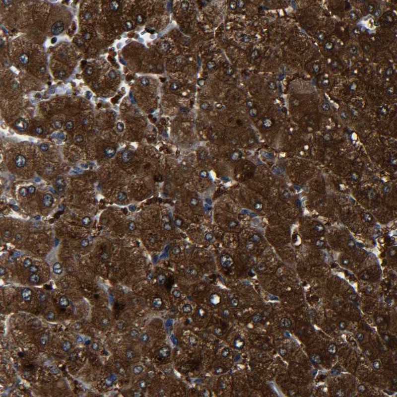 Atlas Antibodies Anti-PREB Antibody
