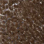 Atlas Antibodies Anti-PREB Antibody