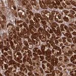 Atlas Antibodies Anti-PREP Antibody