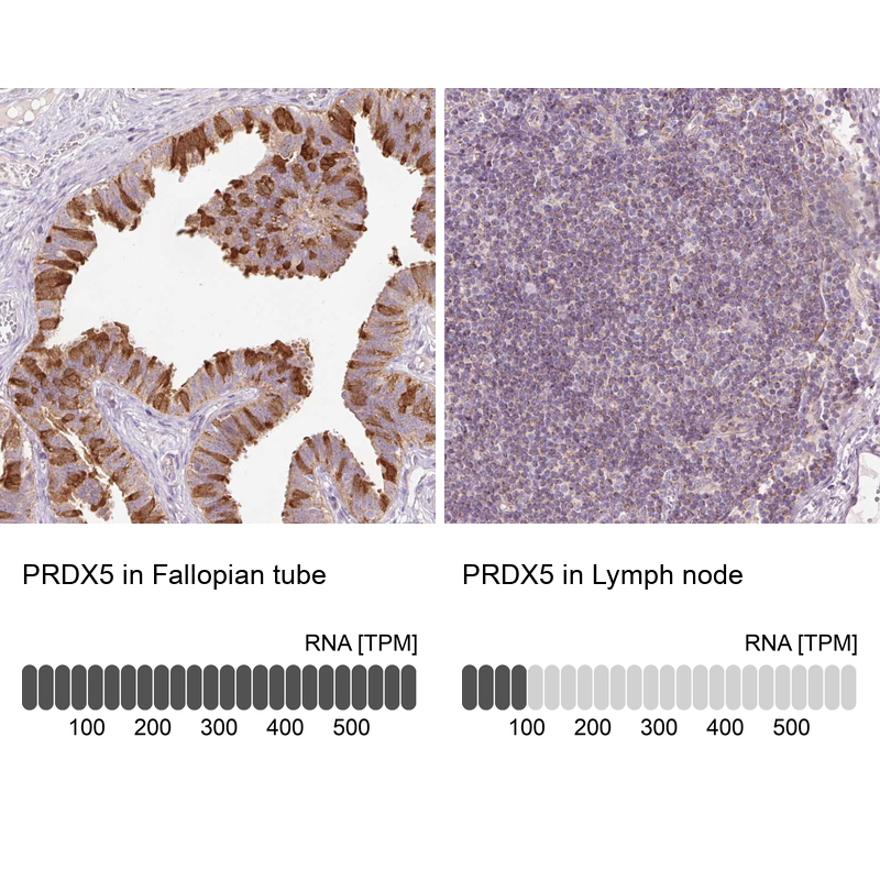 Atlas Antibodies Anti-PRDX5 Antibody