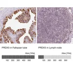 Atlas Antibodies Anti-PRDX5 Antibody