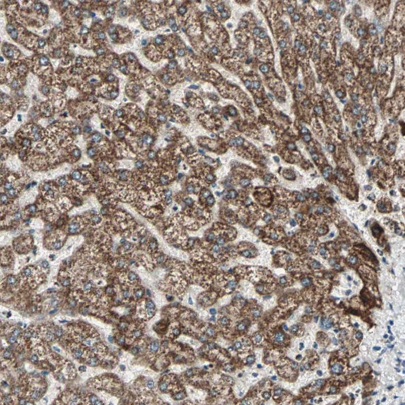 Atlas Antibodies Anti-PRELID1 Antibody