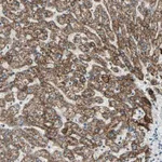 Atlas Antibodies Anti-PRELID1 Antibody