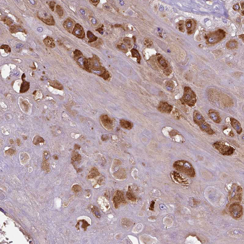 Atlas Antibodies Anti-PRG2 Antibody