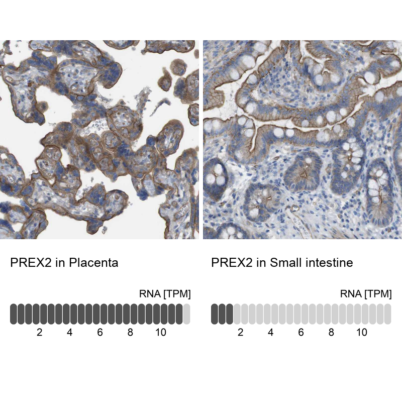 Atlas Antibodies Anti-PREX2 Antibody