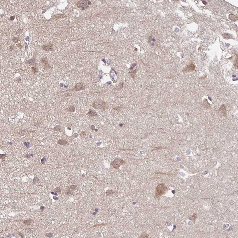 Atlas Antibodies Anti-PREPL Antibody