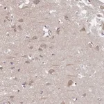 Atlas Antibodies Anti-PREPL Antibody