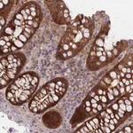 Atlas Antibodies Anti-PREP Antibody