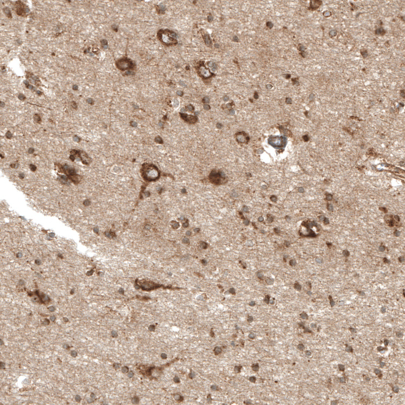 Atlas Antibodies Anti-PREX1 Antibody