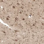 Atlas Antibodies Anti-PREX1 Antibody