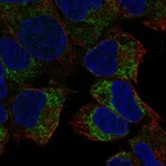 Atlas Antibodies Anti-PREX2 Antibody