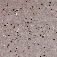 Atlas Antibodies Anti-PRICKLE4 Antibody