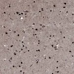 Atlas Antibodies Anti-PRICKLE4 Antibody