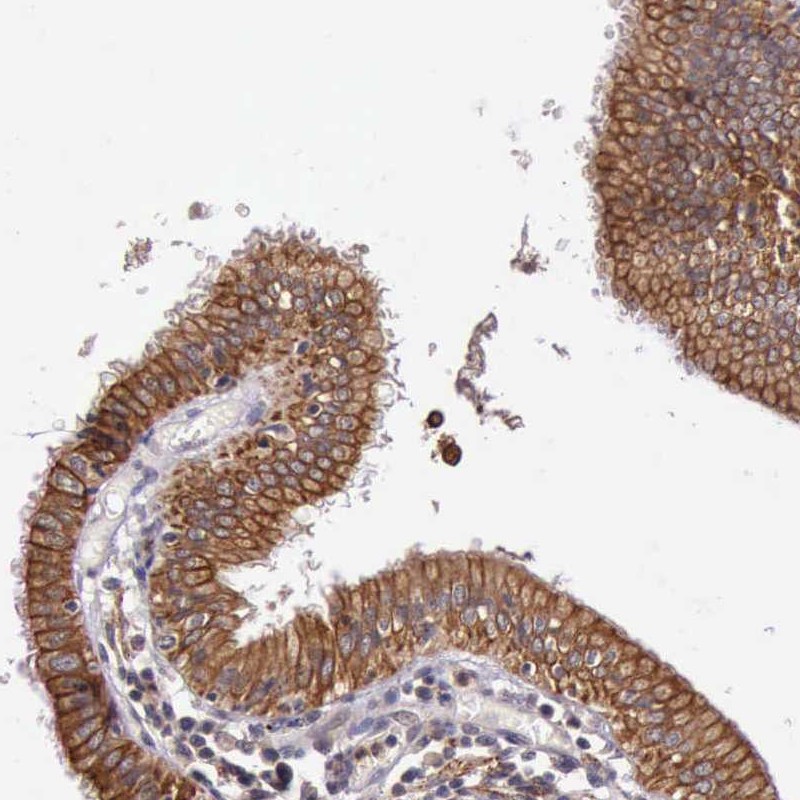 Atlas Antibodies Anti-PRICKLE3 Antibody